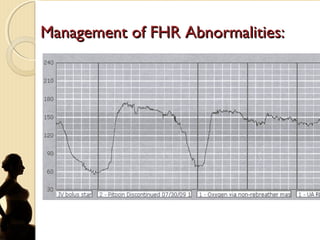 Management of FHR Abnormalities:Management of FHR Abnormalities:
Optimize maternal oxygenation, ventilation,
acid-base status
Expand maternal blood volume
Increased maternal perfusion pressure
Increased maternal oxygen-carrying
capacity
LUD, repositioning surgical retractors
 
