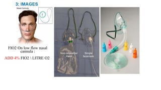 Fio2 Device Types Comprehensive Overview of Anesthesia Practices and Emergency Care | PDF