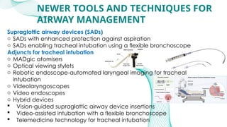 Anesthesia_for_Airway_management_and_Difficult_airway_Algorithmss[1][1 ...