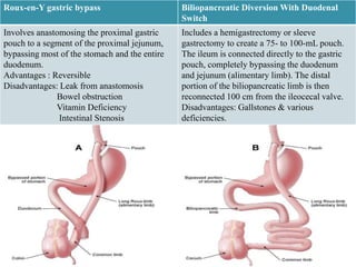 Roux-en-Y gastric bypass                       Biliopancreatic Diversion With Duodenal
                                               Switch
Involves anastomosing the proximal gastric     Includes a hemigastrectomy or sleeve
pouch to a segment of the proximal jejunum,    gastrectomy to create a 75- to 100-mL pouch.
bypassing most of the stomach and the entire   The ileum is connected directly to the gastric
duodenum.                                      pouch, completely bypassing the duodenum
Advantages : Reversible                        and jejunum (alimentary limb). The distal
Disadvantages: Leak from anastomosis           portion of the biliopancreatic limb is then
              Bowel obstruction                reconnected 100 cm from the ileocecal valve.
              Vitamin Deficiency               Disadvantages: Gallstones & various
               Intestinal Stenosis             deficiencies.
 