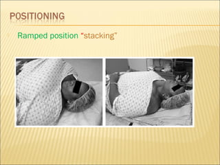 Anesthesia Ramp Position Anesthesia for bariatric surgery asma | PPT