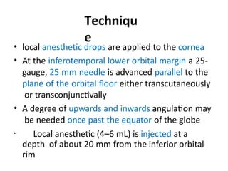 Transcutaneously Anesthesia for Cataract Surgery DR PPS.pptx