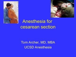 Comprehensive Anesthesia Management for Cesarean Section: Techniques ...