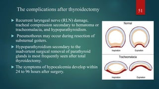 Anesthesia For Coexisting Diseases .pptx