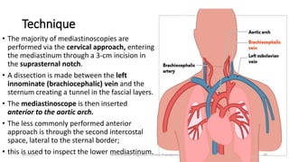Anesthesia for diagnostic thoracic procedures | PPTX