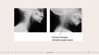 23 Presentation title 20XX
 