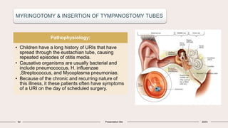 62 Presentation title 20XX
MYRINGOTOMY & INSERTION OF TYMPANOSTOMY TUBES
Pathophysiology:
• Children have a long history of URIs that have
spread through the eustachian tube, causing
repeated episodes of otitis media.
• Causative organisms are usually bacterial and
include pneumococcus, H. influenzae
,Streptococcus, and Mycoplasma pneumoniae.
• Because of the chronic and recurring nature of
this illness, it these patients often have symptoms
of a URI on the day of scheduled surgery.
 