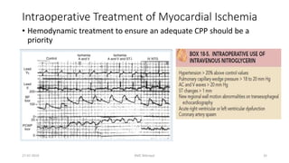 Anesthesia for off Pump Coronary artery bypass grafting | PPTX