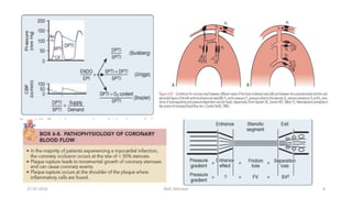 Anesthesia for off Pump Coronary artery bypass grafting | PPTX