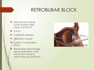 Anesthesia for ophthalmic surgeries.pptx