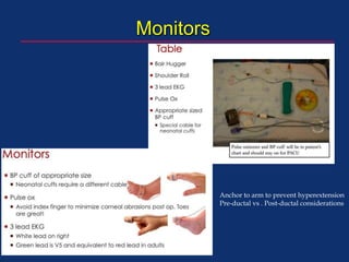 Monitors
Anchor to arm to prevent hyperextension
Pre-ductal vs . Post-ductal considerations
 
