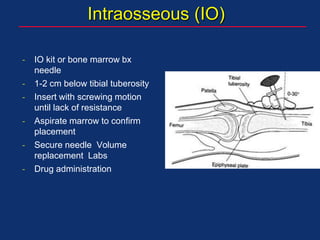 Intraosseous (IO)
- IO kit or bone marrow bx
needle
- 1-2 cm below tibial tuberosity
- Insert with screwing motion
until lack of resistance
- Aspirate marrow to confirm
placement
- Secure needle Volume
replacement Labs
- Drug administration
 