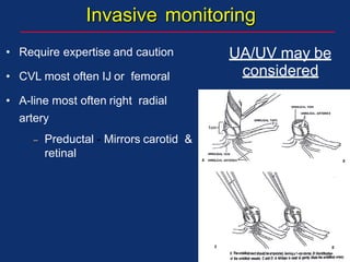 Invasive monitoring
• Require expertise and caution
• CVL most often IJ or femoral
• A-line most often right radial
artery
– Preductal - Mirrors carotid &
retinal
UA/UV may be
considered
 