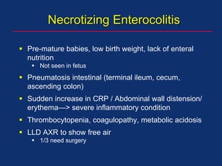 Necrotizing Enterocolitis
 Pre-mature babies, low birth weight, lack of enteral
nutrition
 Not seen in fetus
 Pneumatosis intestinal (terminal ileum, cecum,
ascending colon)
 Sudden increase in CRP / Abdominal wall distension/
erythema—> severe inflammatory condition
 Thrombocytopenia, coagulopathy, metabolic acidosis
 LLD AXR to show free air
 1/3 need surgery
 