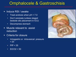 Omphalocele & Gastroschisis
 Induce RSI / awake
• Treat acidosis when pH < 7.0
• Don’t extubate (unless staged
bedside silo placement in ICU)
• Decompress stomach
 Muscle relaxant to assist
reduction
 Criteria for closure
• Intragastric or intravesical pressure
< 20
• PIP < 35
• EtCO2 < 50
 