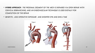 Comprehensive Anesthesia Management for Thoracic Aorta Diseases and ...