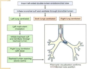 Anesthesia for thoracic surgery (2) (4).pptx