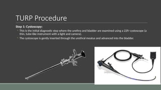 Anesthesia for TURP .................... | PPTX