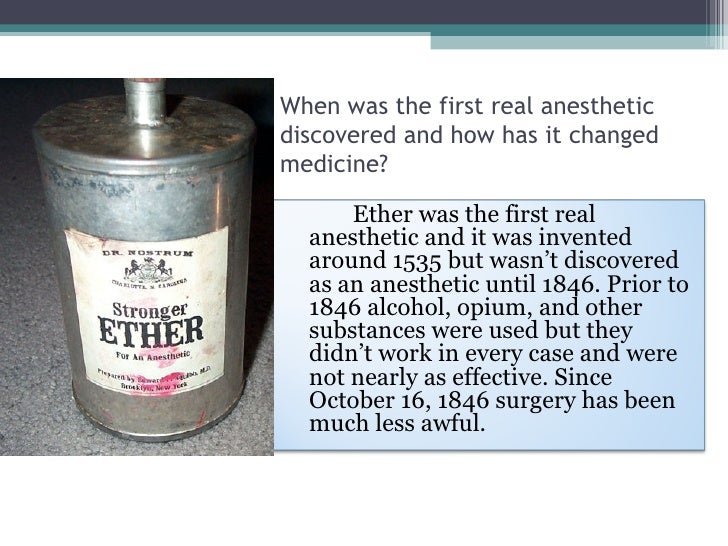Anesthesia History of Ether