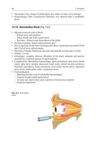 86
•	 Advantages: Less chance of globe injury, less chance of optic nerve damage.
•	 Disadvantages: Pain, Conjunctival Chemosis, less akinesia than a retrobulbar
block.
13.10	 Retrobulbar Block (Fig. 13.2)
•	 Injected in muscle cone to block
–– Ciliary nerve and ganglion
–– Third, fourth and sixth cranial nerves
–– Provides—Akinesia and Anaesthesia of the globe.
•	 Position of patient: Supine and in primary gaze
•	 Site of injection: In the lower lid margin just above a point between medial 2/3rd
and 1/3rd of lower orbital margin.
•	 Direction of needle: Backward, upwards and medially towards apex of orbit
•	 Volume: 2–4 mL
•	 Advantages: complete akinesia, dilatation of the pupil, adequate and quicker
anaesthesia, a minimal amount of agent required.
•	 Complications: Retrobulbar haemorrhage, globe penetration, optic nerve sheath
injury, optic nerve atrophy, decreased visual acuity, retinal vascular occlusion,
brainstem anaesthesia, frank convulsion, extra ocular muscle palsy, trigeminal
nerve block, oculocardiac reflex, respiratory arrest.
•	 Contraindication:
–– Bleeding disorder (risk of retrobulbar haemorrhage)
–– Extreme myopia (globe perforation)
–– An open eye injury (may cause expulsion of intraocular contents)
–– Posterior staphyloma
Fig. 13.2 Retrobulbar
block
S. Chouhan
 