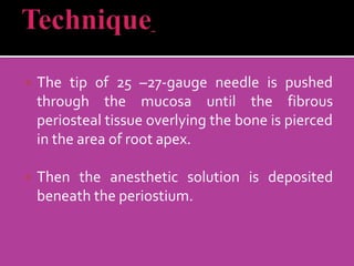  The tip of 25 –27-gauge needle is pushed
through the mucosa until the fibrous
periosteal tissue overlying the bone is pierced
in the area of root apex.
 Then the anesthetic solution is deposited
beneath the periostium.
 