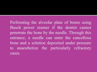  Perforating the alveolar plate of bones using
Busch power reamer if the dentist cannot
penetrate the bone by the needle. Through this
entrance, a needle can enter the cancellous
bone and a solution deposited under pressure
to anaesthetize the particularly refractory
cases.
 
