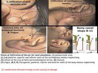Anesthesia in ENT.pptx