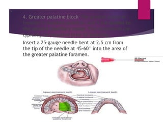 Anesthesia in ENT.pptx