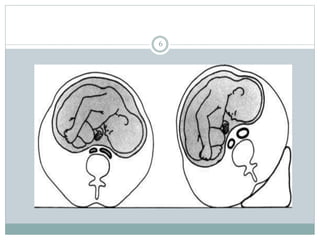 anesthesia in OB.pptx