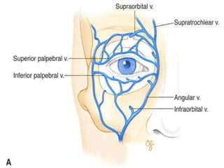 Subopercular Anesthesia in ophthalmic surgery | PPTX