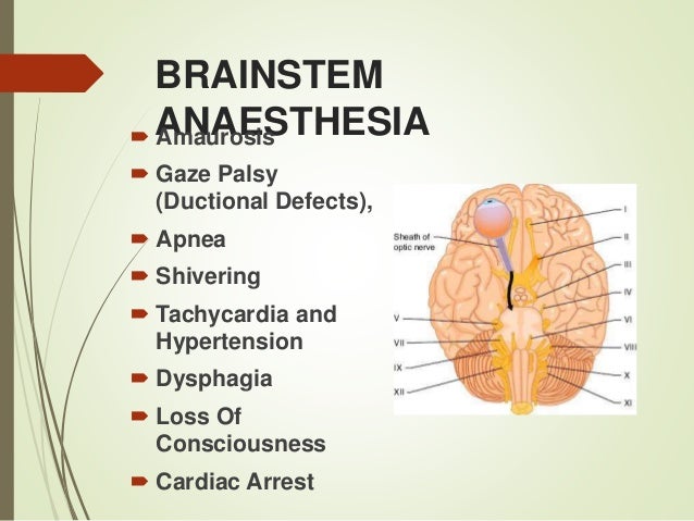 anesthesia for retina detachment surgery elderly anesthesia for retina detachment surgery elderly