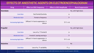 Anesthesia and IONM | PPTX