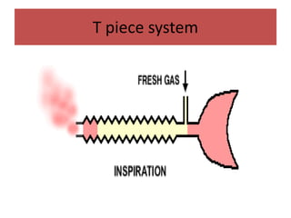 T piece system
 