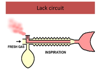 Lack circuit
 