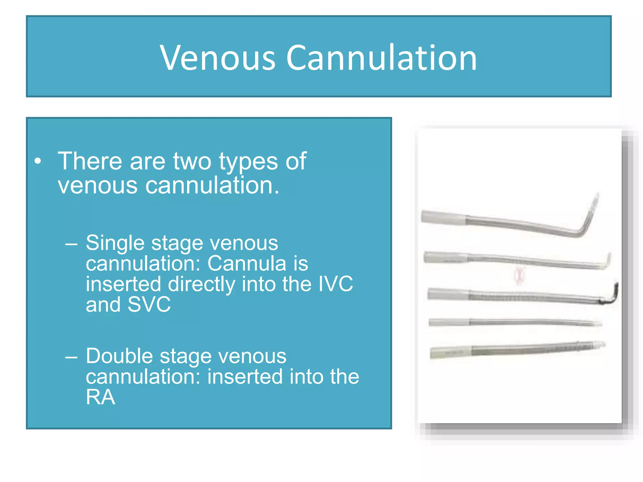 Venous Cannulation
• There are two types of
venous cannulation.
– Single stage venous
cannulation: Cannula is
inserted directly into the IVC
and SVC
– Double stage venous
cannulation: inserted into the
RA
 