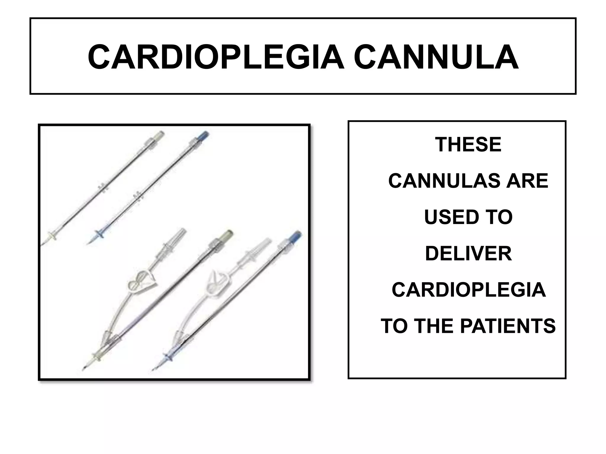 CARDIOPLEGIA CANNULA
THESE
CANNULAS ARE
USED TO
DELIVER
CARDIOPLEGIA
TO THE PATIENTS
 
