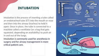 Anesthesia (surgery presentation).pptx.md