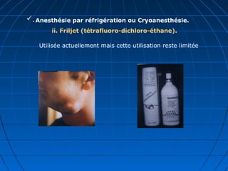 .Anesthésie par réfrigération ou Cryoanesthésie.
ii. Friljet (tétrafluoro-dichloro-éthane).
Utilisée actuellement mais cette utilisation reste limitée
 