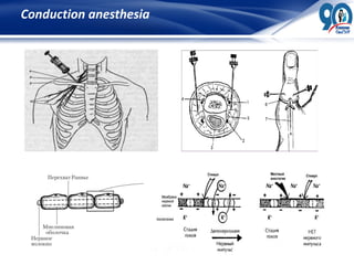 BASICS OF ANESTHESIOLOGY - LECTION (GENERAL SURGERY) | PDF