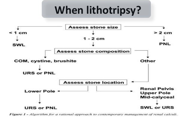 kidney stone crusher