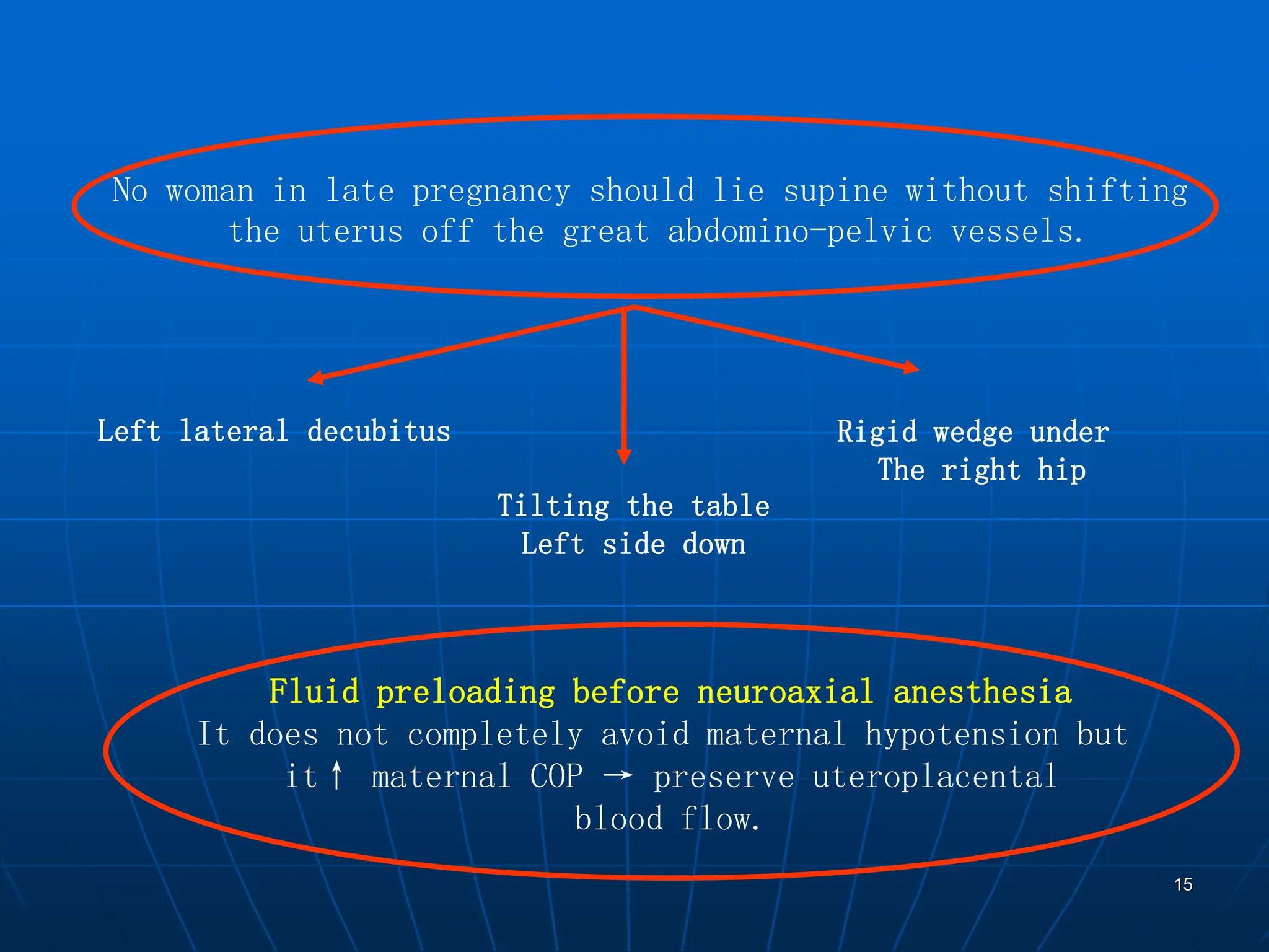 15
No woman in late pregnancy should lie supine without shifting
the uterus off the great abdomino-pelvic vessels.
Left lateral decubitus
Tilting the table
Left side down
Rigid wedge under
The right hip
Fluid preloading before neuroaxial anesthesia
It does not completely avoid maternal hypotension but
it↑ maternal COP → preserve uteroplacental
blood flow.
 
