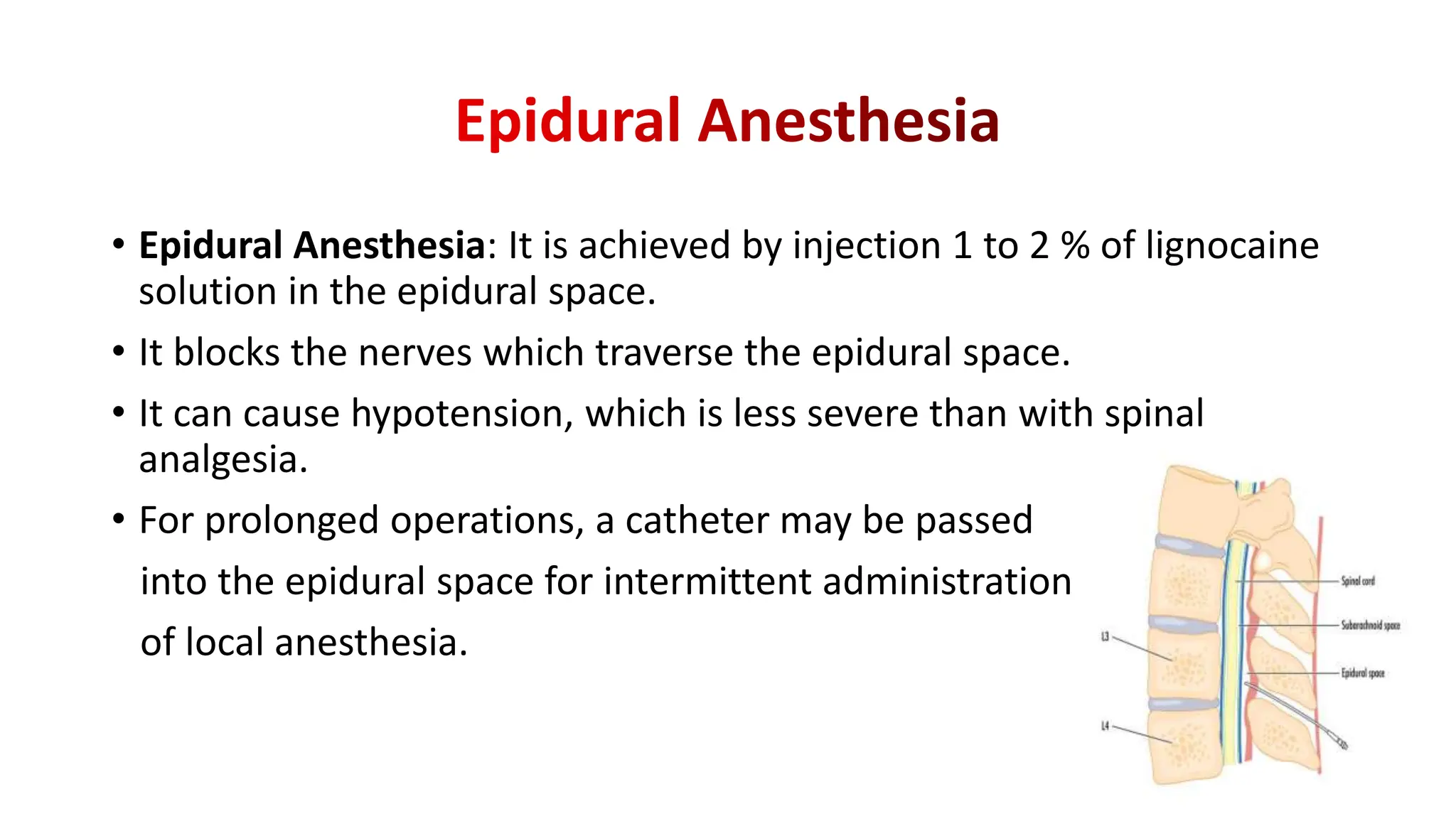 • Epidural Anesthesia: It is achieved by injection 1 to 2 % of lignocaine
solution in the epidural space.
• It blocks the nerves which traverse the epidural space.
• It can cause hypotension, which is less severe than with spinal
analgesia.
• For prolonged operations, a catheter may be passed
into the epidural space for intermittent administration
of local anesthesia.
 
