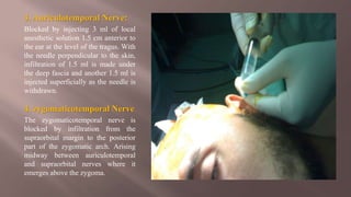 3. Auriculotemporal Nerve:
Blocked by injecting 3 ml of local
anesthetic solution 1.5 cm anterior to
the ear at the level of the tragus. With
the needle perpendicular to the skin,
infiltration of 1.5 ml is made under
the deep fascia and another 1.5 ml is
injected superficially as the needle is
withdrawn.
4. zygomaticotemporal Nerve
The zygomaticotemporal nerve is
blocked by infiltration from the
supraorbital margin to the posterior
part of the zygomatic arch. Arising
midway between auriculotemporal
and supraorbital nerves where it
emerges above the zygoma.
 