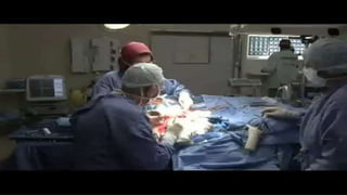 Awake Craniotomy