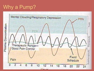 Why a Pump?
 