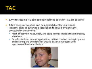  0.5% tetracaine + 1:200,000 epinephrine solution+ 11.8% cocaine
 A few drops of solution can be applied directly to a wound
(<10cm) prior to suturing a laceration followed by constant
pressure for 10-20mins
 Most effective in head, neck, and scalp injuries in pediatric emergency
situations
 Benefits include: ease of application, patient comfort during irrigation
and suturing and avoidance of wound distortion present with
injections of local anesthetics/
 
