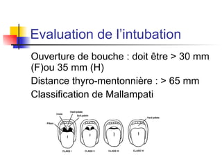 Passage obligatoire en SSPI 