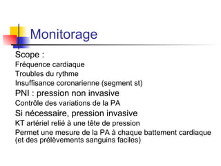 Rechercher des critères d’intubation difficile 