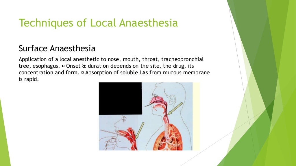 general and local anesthesia