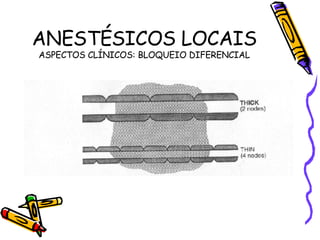 ANESTÉSICOS LOCAIS ASPECTOS CLÍNICOS: BLOQUEIO DIFERENCIAL 